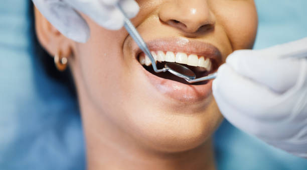Best Emergency Wisdom Teeth Removal in Riverside, OH